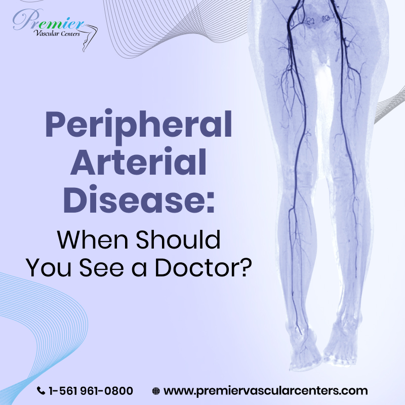 peripheral arterial disease treatment in Boca Raton