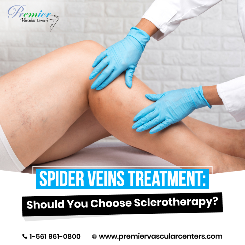 spider vein treatments