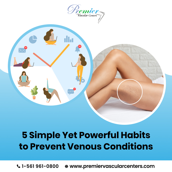 Vein Treatment Clinic Boca Raton