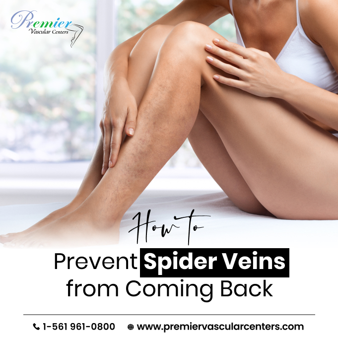 spider vein removal treatments