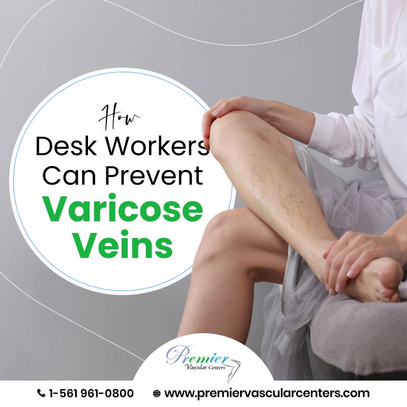 varicose vein treatment in Boca Raton